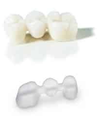 Ganzheitliche Zahnmedizin Metallfreier Zahnersatz